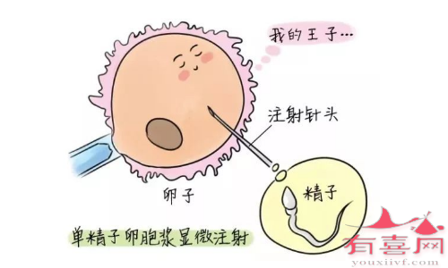 襄阳捐卵：抗卵巢抗体阳性意味着什么？